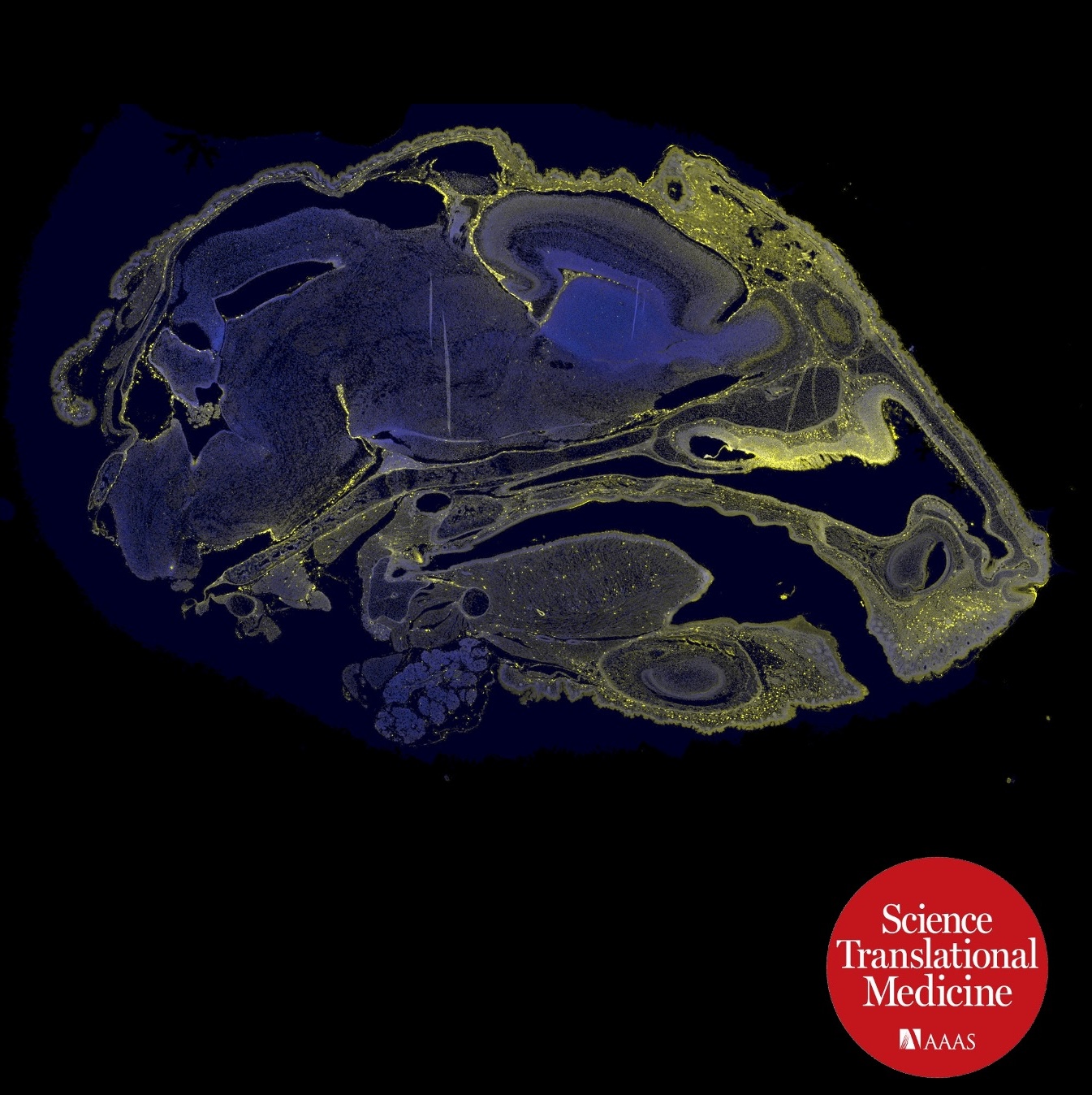 Microscopic cross-section of a mouse head stained with fluorescent markers, showing ASO 449323–Cy3, yellow, and nuclei stained blue in the brain; Science Translational Medicine logo in the corner